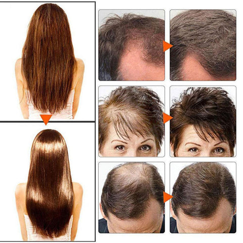 Šampūnas Su Imbieru | Atstatykite Savo Plaukus Akimirksniu