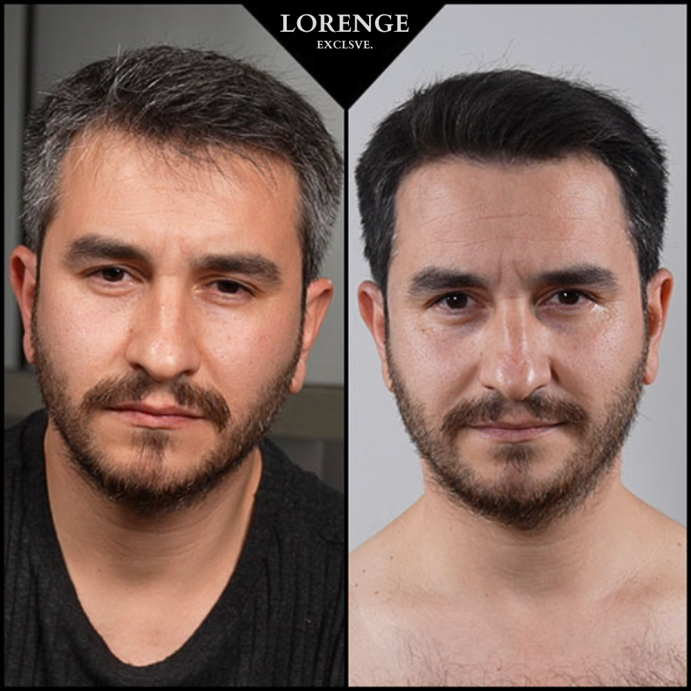 Anti-Gray™ Sausas Šampūnas Nuo Žilų Plaukų