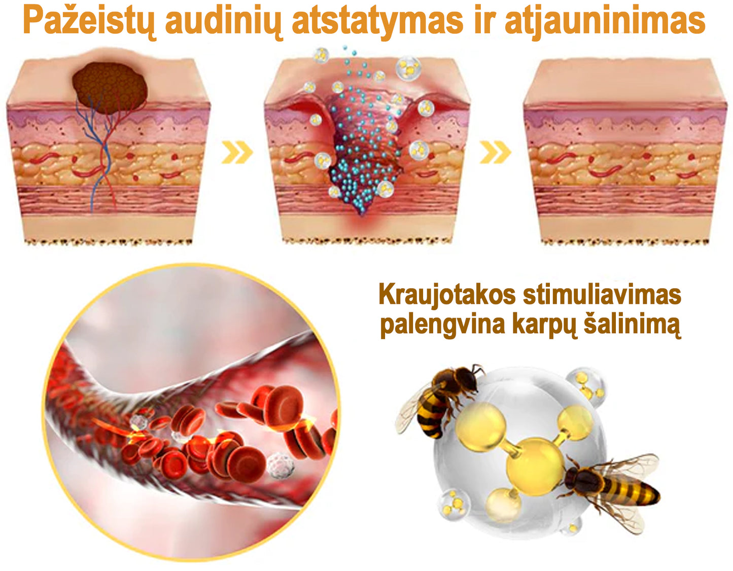 Flysmus™ Gydomasis Bičių Nuodų Purškalas | Pašalina Nepageidaujamas Odos Ataugas